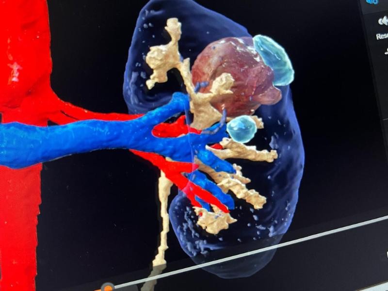 Tratamento dor no cotovelo